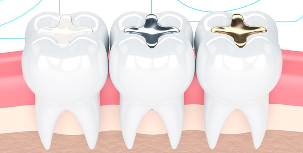 foto de um tipo de serviço